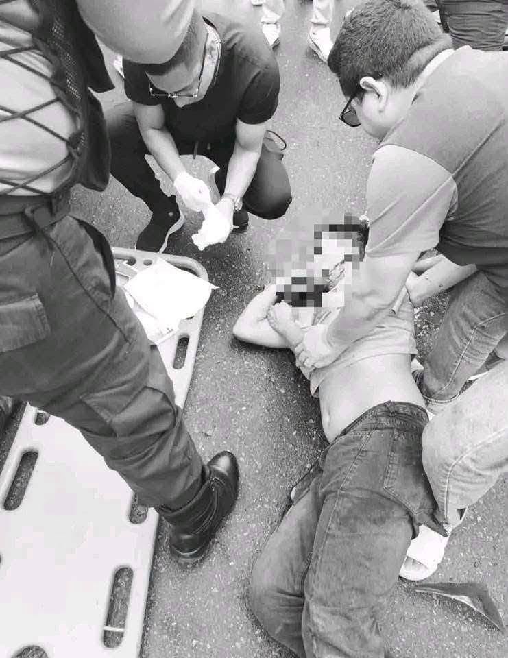 MOTOCICLISTA QUEDA GRAVEMENTE HERIDO TRAS IMPACTAR CONTRA AUTO ESTACIONADO EN EL CENTRO DE IQUITOS